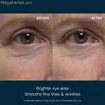 Դեմքի կրեմ Էլեմիս ՊՐՈ-ԿՈԼԱԳԵՆ 15 մլ